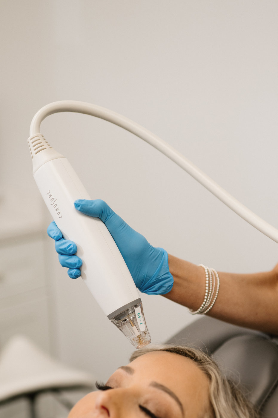 Microneedling at Refresh Med Spa