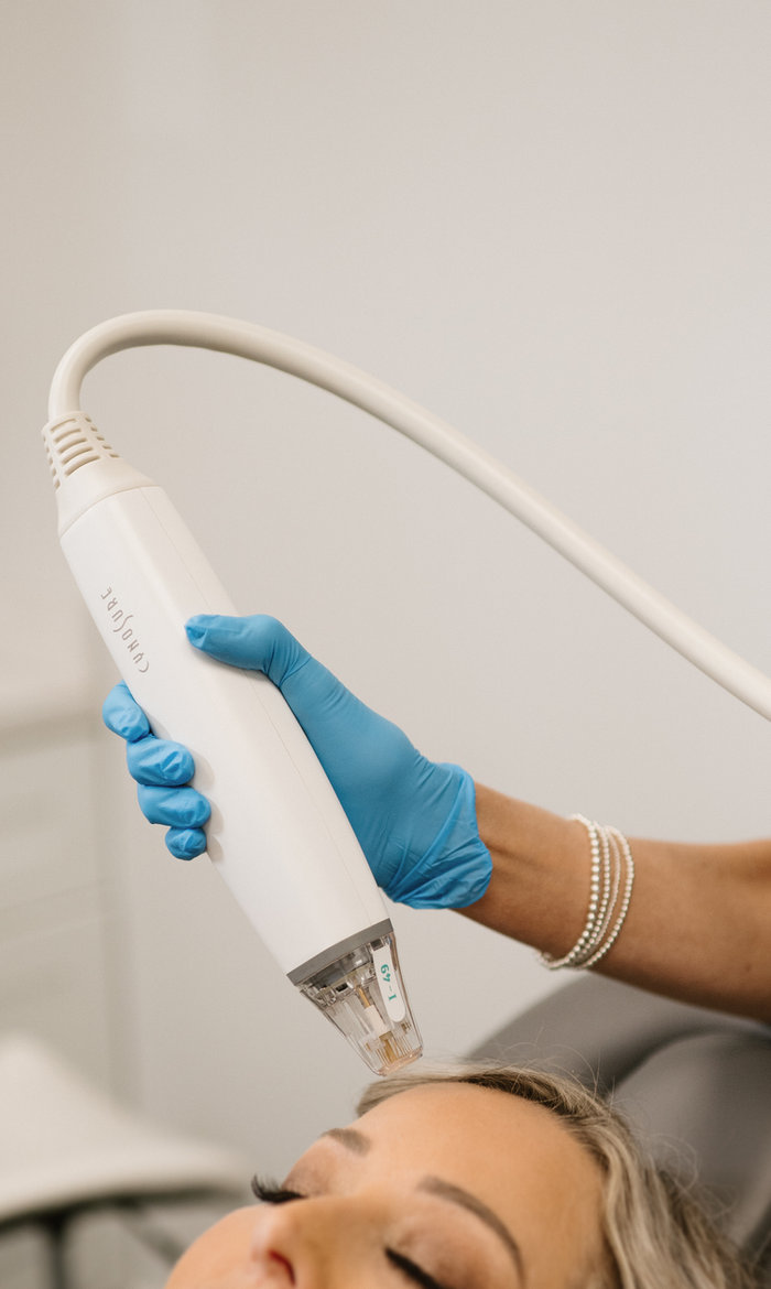 Lasers at Refresh Med Spa